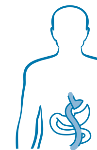 Adipositaschirurgie